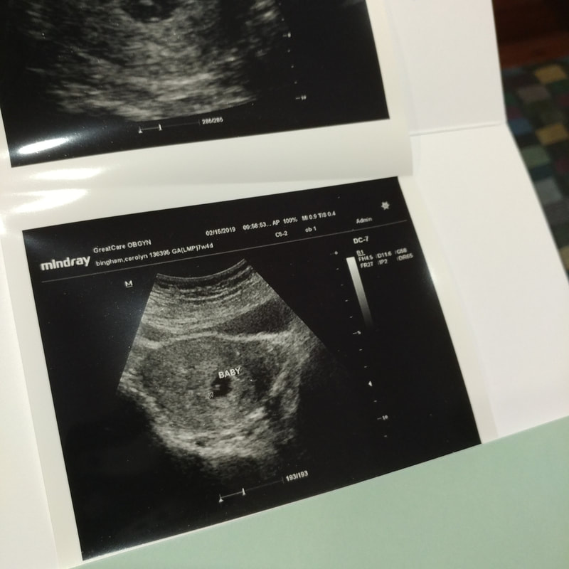 On Love and Loss: Pregnancy and Miscarriage; Ultra Sound Showing Baby; Strong heartbeat